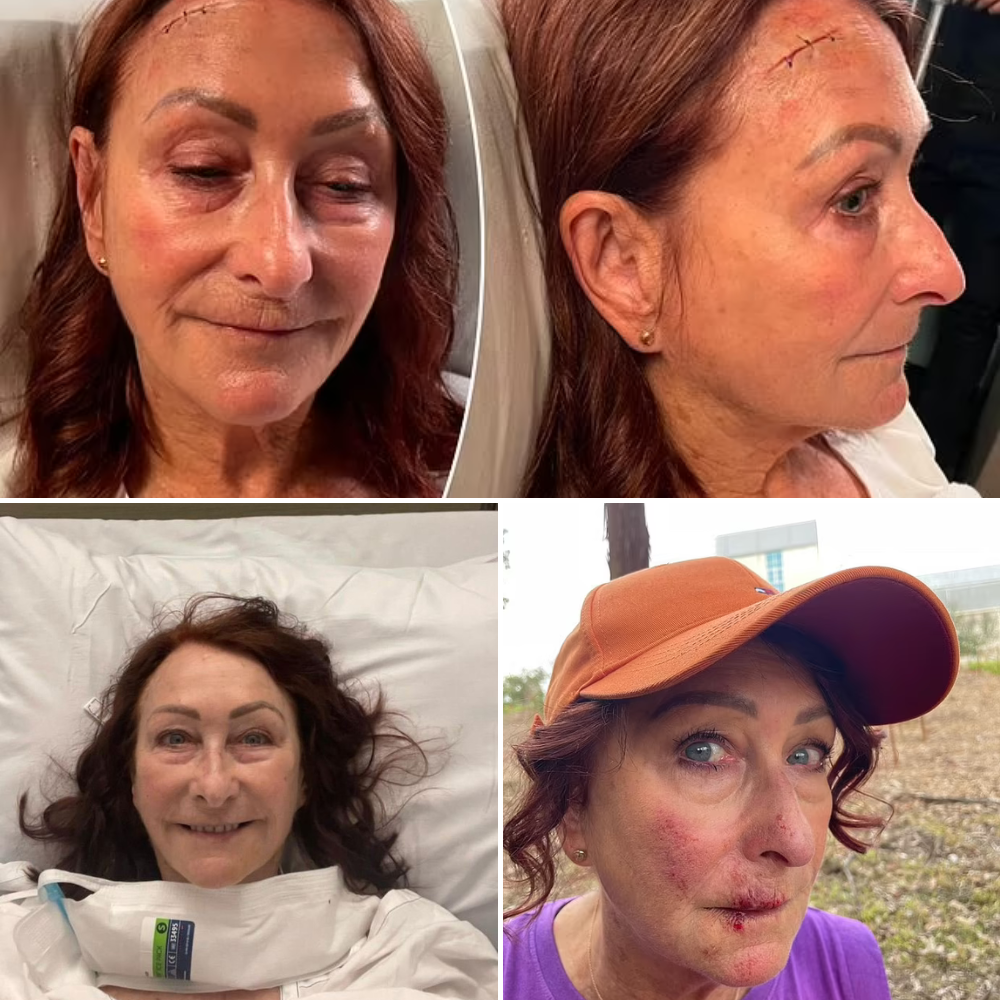Lynne McGranger: Home and Away star shares health update on toxic overactive thyroid from hospital bed